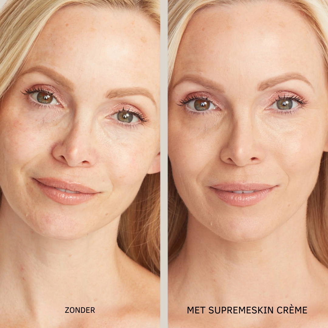 SupremeSkin – Waterdichte Concealer met Ultieme Hydratatie & Flawless Dekking