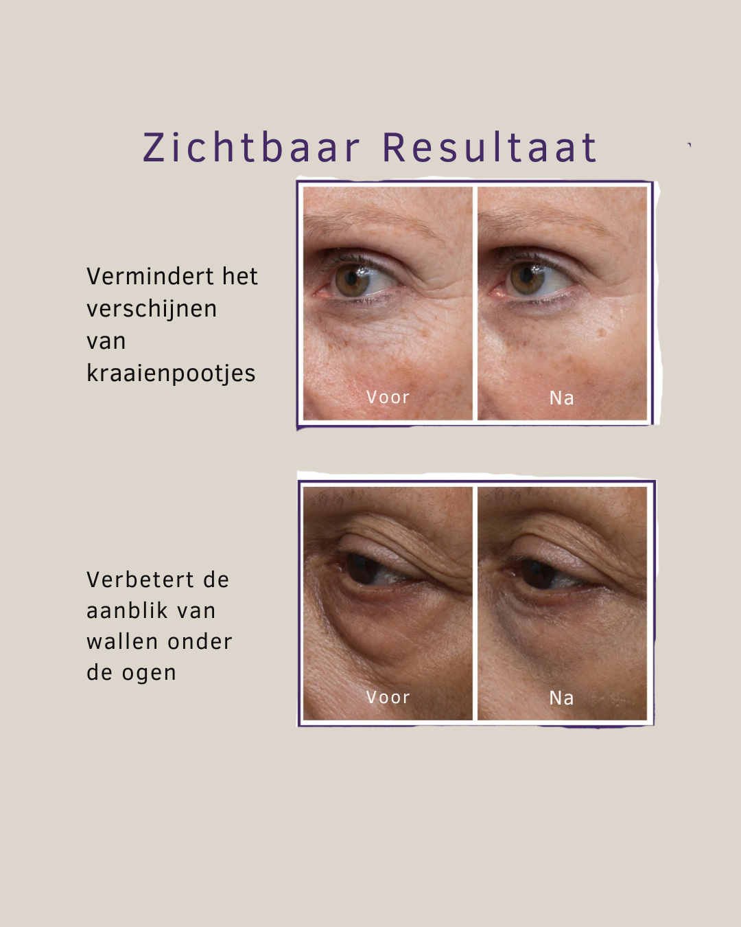 Lumi Eye Lift– Onmiddellijk verdoezelen, verstevigen en liften – voor een frisse, jeugdige uiterlijk