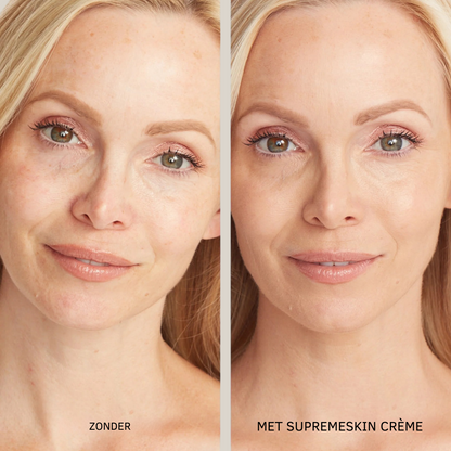 SupremeSkin – Waterdichte Concealer met Ultieme Hydratatie & Flawless Dekking